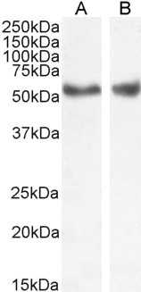 LXR alpha/beta Antibody in Western Blot (WB)