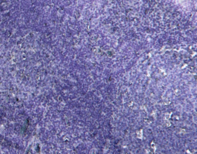 MyD88 Antibody in Immunohistochemistry (Paraffin) (IHC (P))