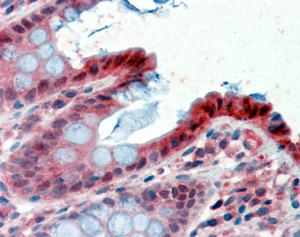 15-PGDH Antibody in Immunohistochemistry (Paraffin) (IHC (P))