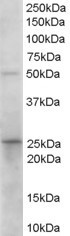 15-PGDH Antibody in Western Blot (WB)