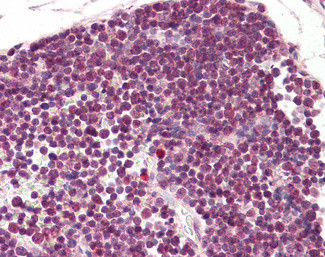 RAN Antibody in Immunohistochemistry (Paraffin) (IHC (P))