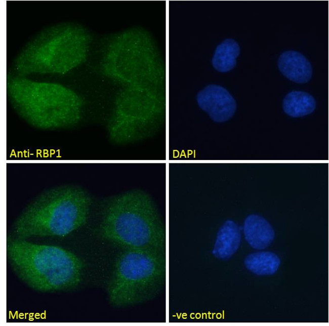 RBP1 Antibody in Immunocytochemistry (ICC/IF)