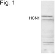 HCN1 Antibody in Western Blot (WB)