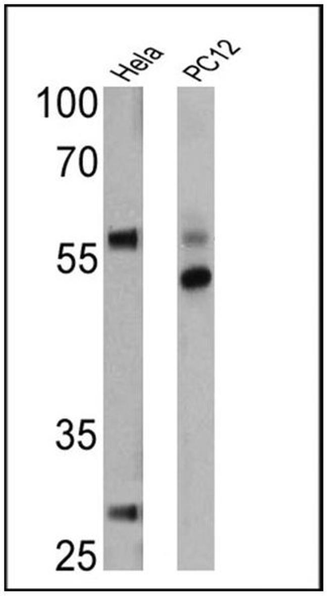 TRAIL-R2 (DR5) Antibody in Western Blot (WB)