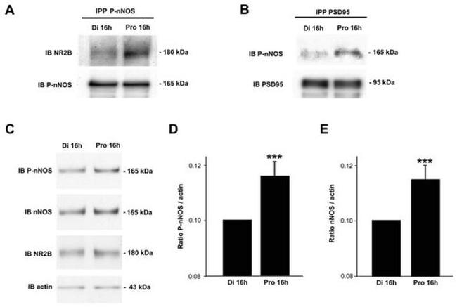 Phospho-nNOS (Ser1417) Antibody in Immunoprecipitation (IP)