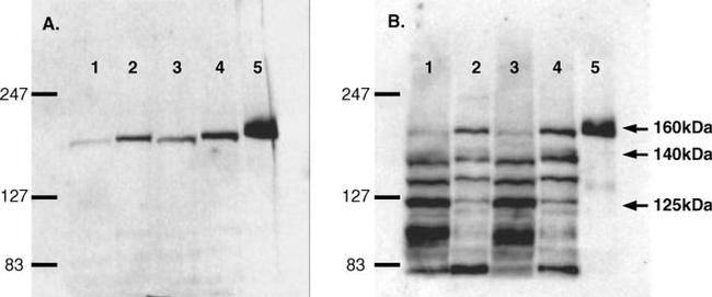 nNOS Antibody in Western Blot (WB)