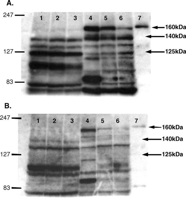 nNOS Antibody in Western Blot (WB)