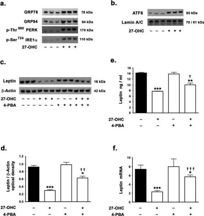 Leptin Antibody in Western Blot (WB)