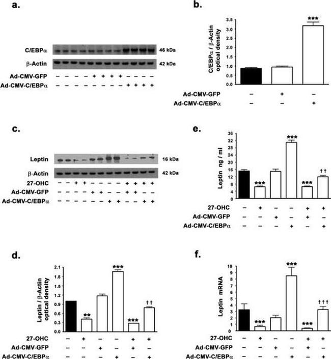 Leptin Antibody in Western Blot (WB)