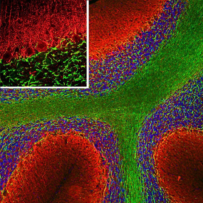 alpha Internexin Antibody in Immunocytochemistry (ICC/IF)