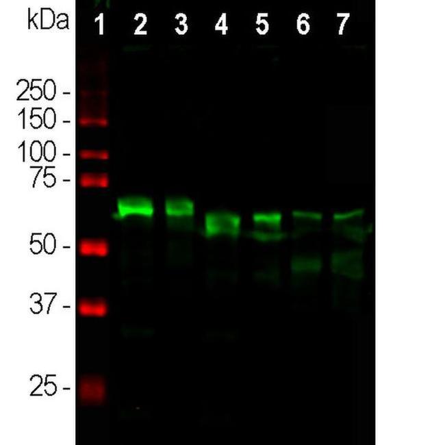 alpha Internexin Antibody in Western Blot (WB)