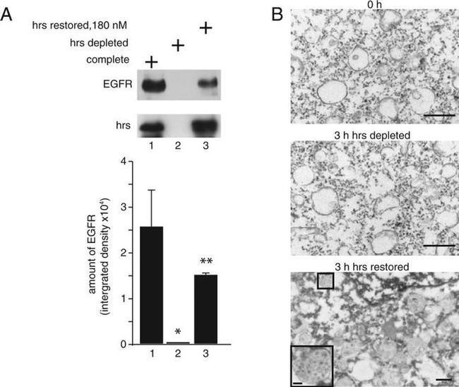 EGFR Antibody in Western Blot (WB)