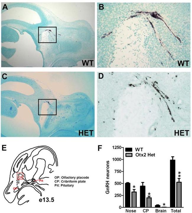 GnRH1 Antibody in Immunohistochemistry (IHC)