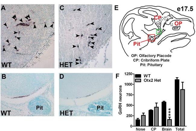 GnRH1 Antibody in Immunohistochemistry (IHC)