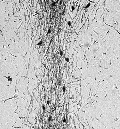 GnRH1 Antibody in Immunohistochemistry (IHC)