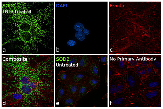 SOD2 Antibody in Immunocytochemistry (ICC/IF)