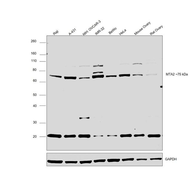 MTA2 Antibody in Western Blot (WB)