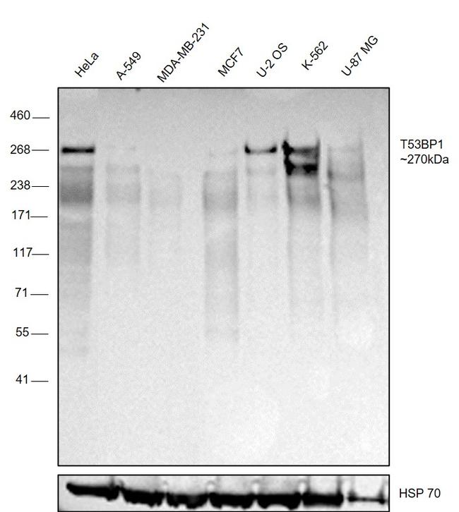 53BP1 Antibody in Western Blot (WB)