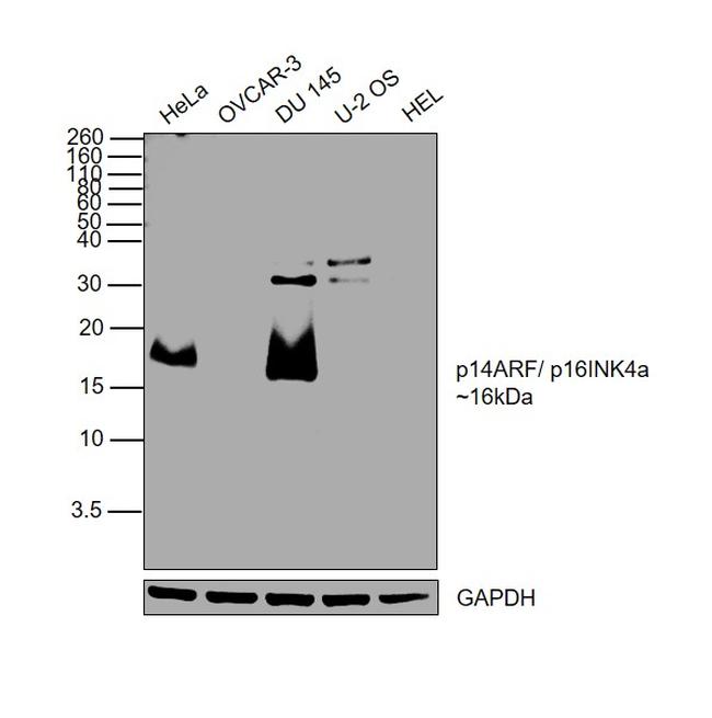 p14ARF Antibody in Western Blot (WB)