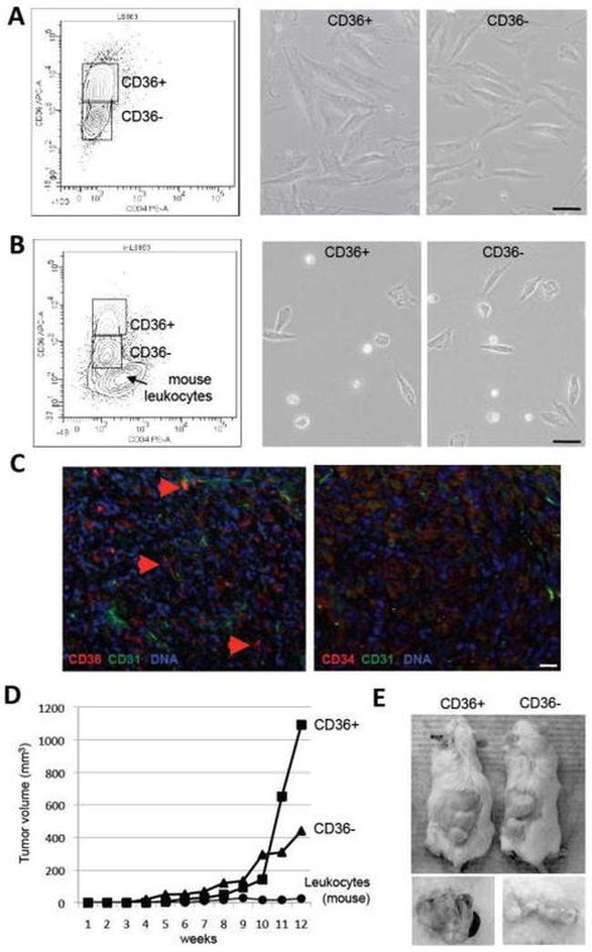 CD36 Antibody in Immunohistochemistry (IHC)