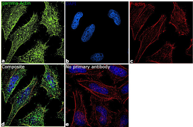 gamma Actin Antibody in Immunocytochemistry (ICC/IF)