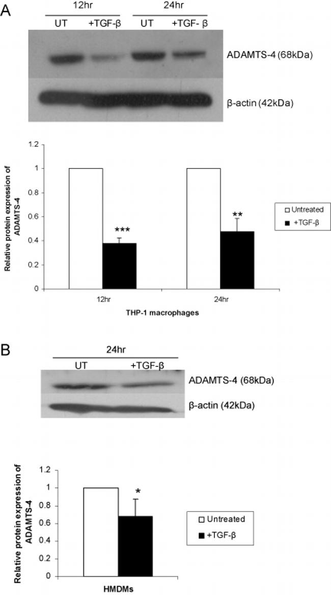 ADAMTS4 Antibody in Western Blot (WB)