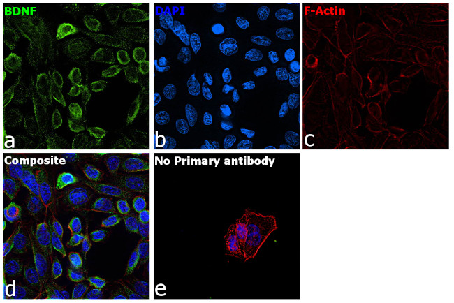 BDNF Antibody in Immunocytochemistry (ICC/IF)