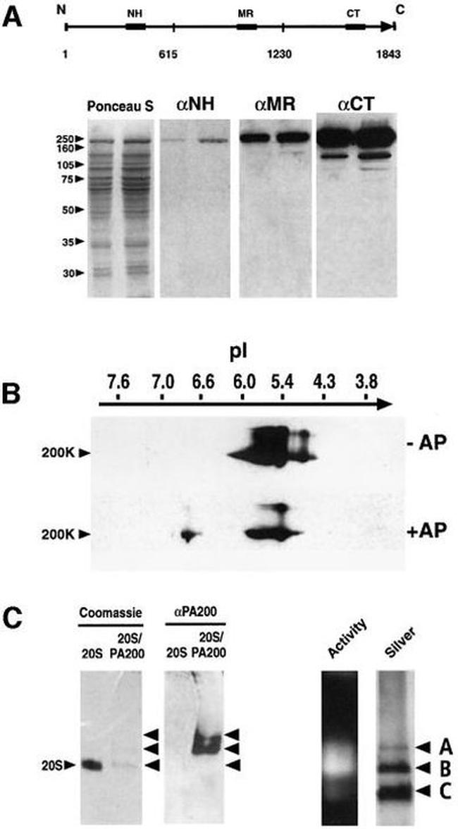 PSME4 Antibody in Western Blot (WB)