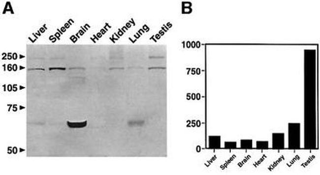 PSME4 Antibody in Western Blot (WB)