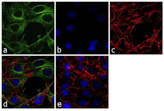 beta Tubulin Antibody in Immunocytochemistry (ICC/IF)