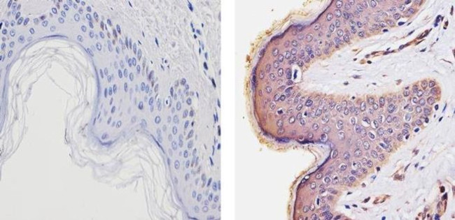 THRA Antibody in Immunohistochemistry (Paraffin) (IHC (P))