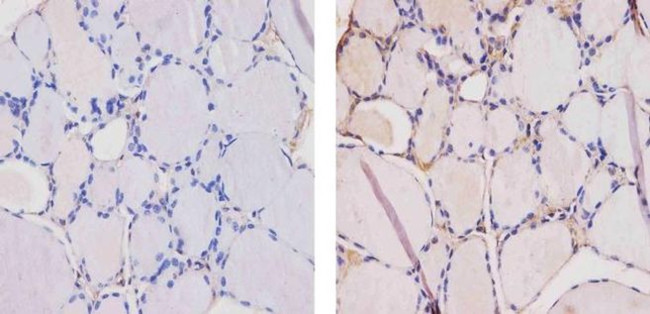 THRA Antibody in Immunohistochemistry (Paraffin) (IHC (P))