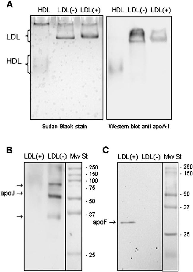 Apolipoprotein J Antibody in Western Blot (WB)