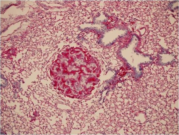 Placental Alkaline Phosphatase Antibody in Immunohistochemistry (Paraffin) (IHC (P))