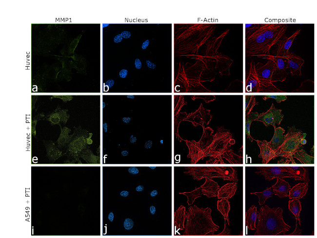 MMP1 Antibody