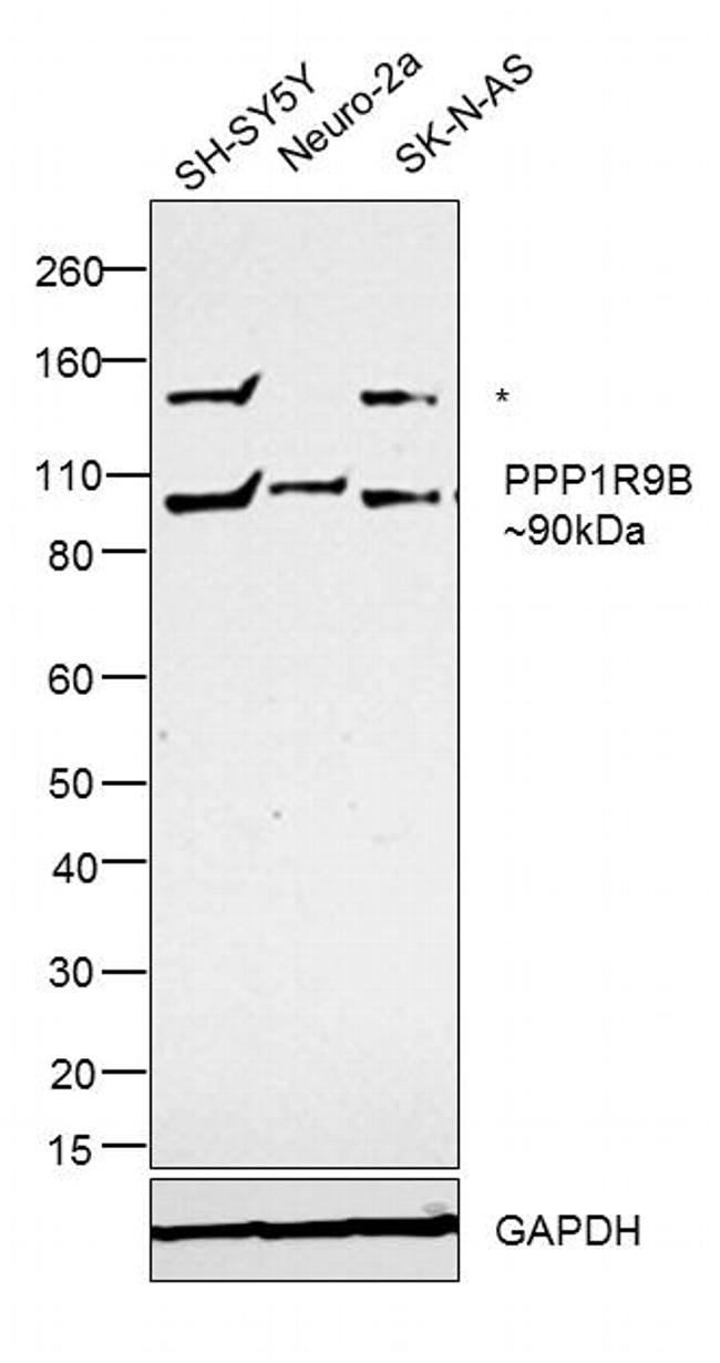 PPP1R9B Antibody in Western Blot (WB)