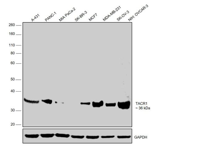 TACR1 Antibody in Western Blot (WB)