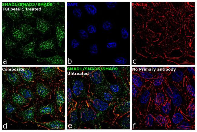 SMAD1/SMAD5/SMAD9 Antibody