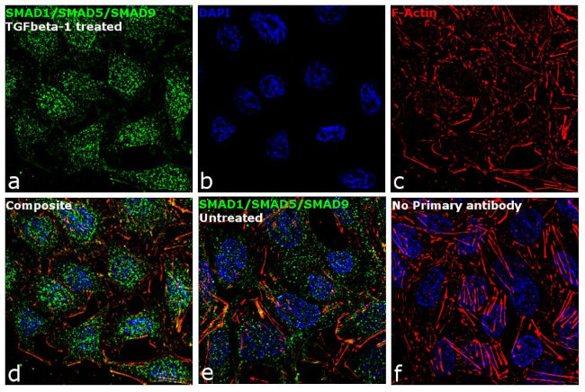 SMAD1/SMAD5/SMAD9 Antibody in Immunocytochemistry (ICC/IF)