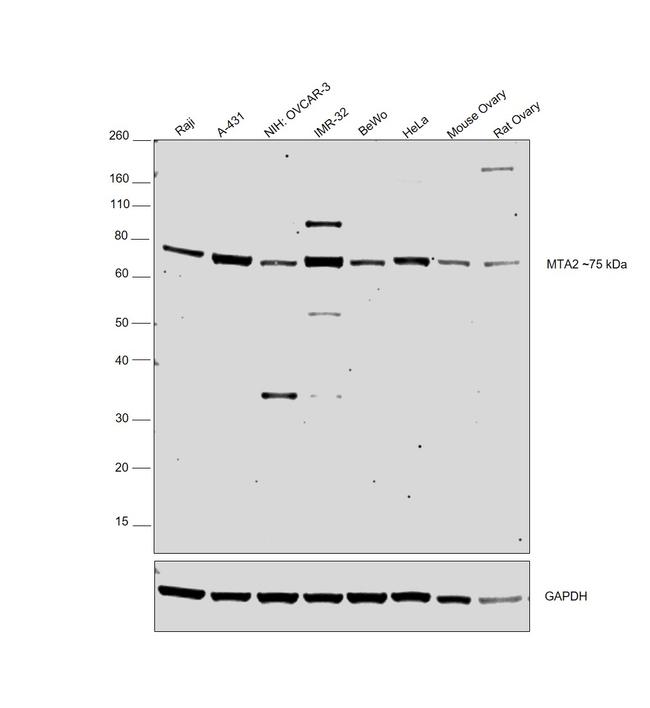 MTA2 Antibody in Western Blot (WB)