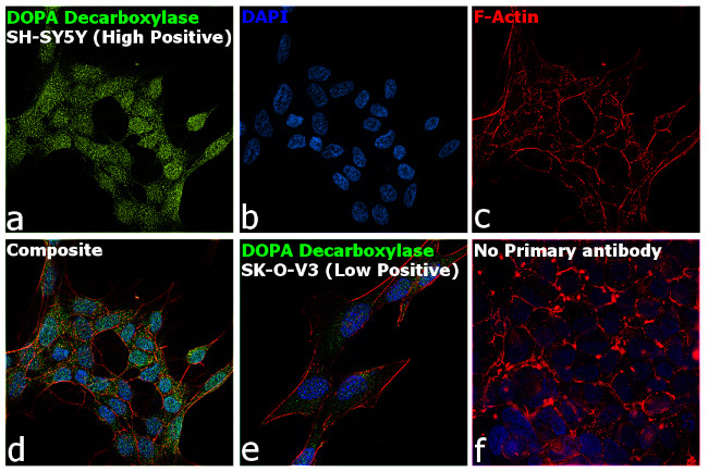 DOPA Decarboxylase Antibody in Immunocytochemistry (ICC/IF)