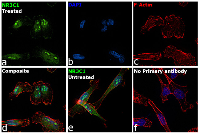 Glucocorticoid Receptor Antibody in Immunocytochemistry (ICC/IF)