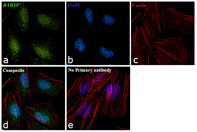 ATRIP Antibody in Immunocytochemistry (ICC/IF)