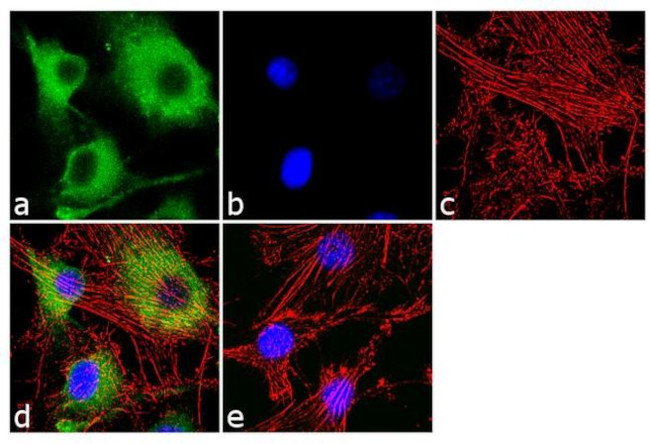 CaMKI Antibody in Immunocytochemistry (ICC/IF)