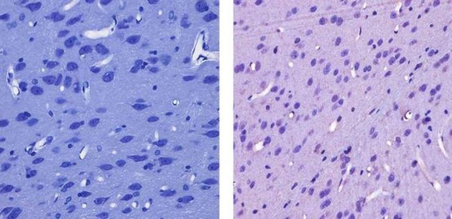 CaMKI Antibody in Immunohistochemistry (Paraffin) (IHC (P))