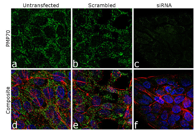 PMP70 Antibody in Immunocytochemistry (ICC/IF)