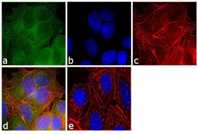 PDE6B Antibody in Immunocytochemistry (ICC/IF)