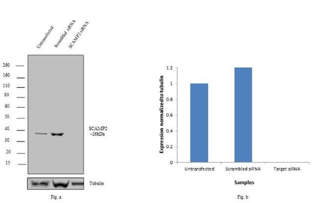 SCAMP2 Antibody in Western Blot (WB)