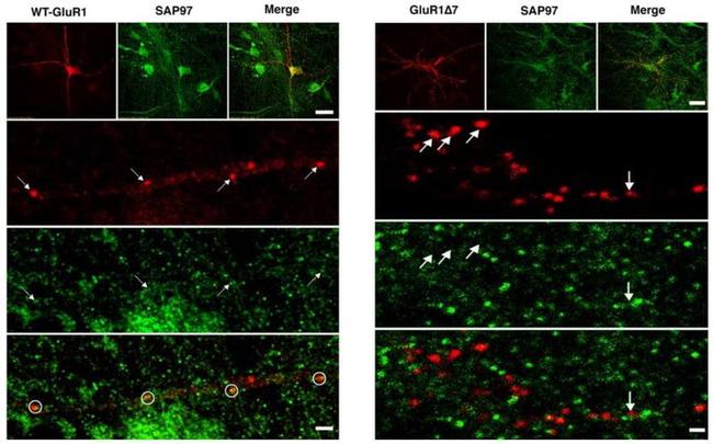 SAP97 Antibody in Immunocytochemistry, Immunohistochemistry (ICC/IF, IHC)