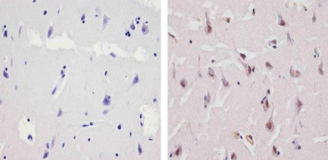 Ubiquilin 1 Antibody in Immunohistochemistry (Paraffin) (IHC (P))